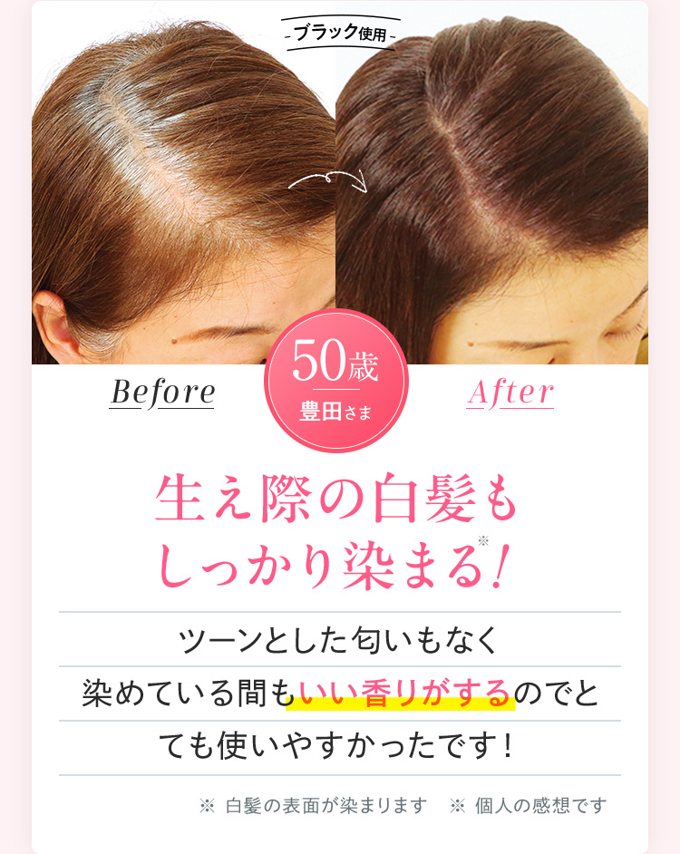 生え際の白髪も しっかり染まる