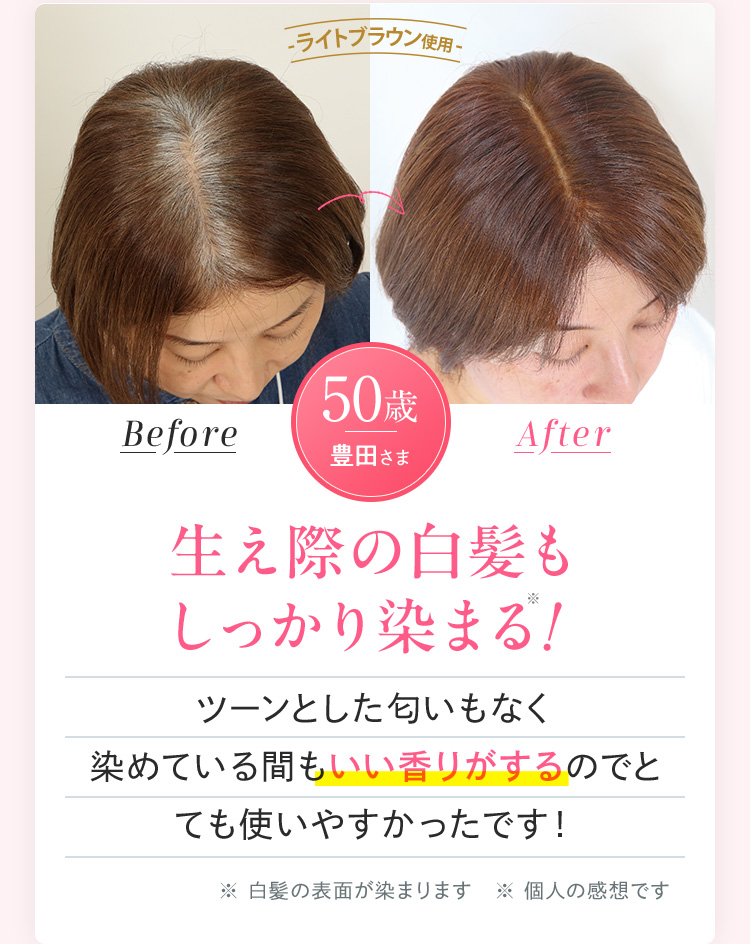 生え際の白髪も しっかり染まる
